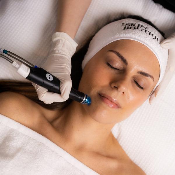 Microneedling