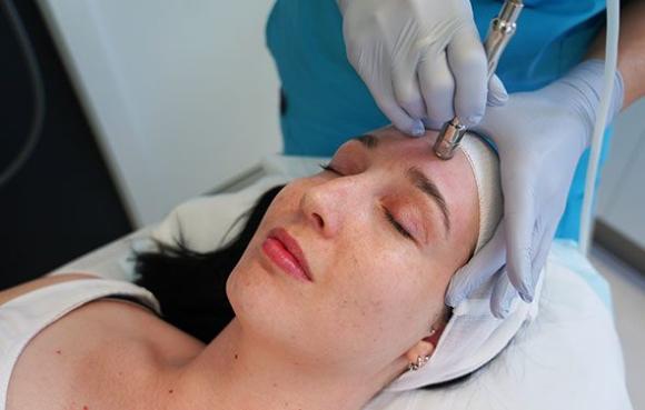 Microdermabrasion